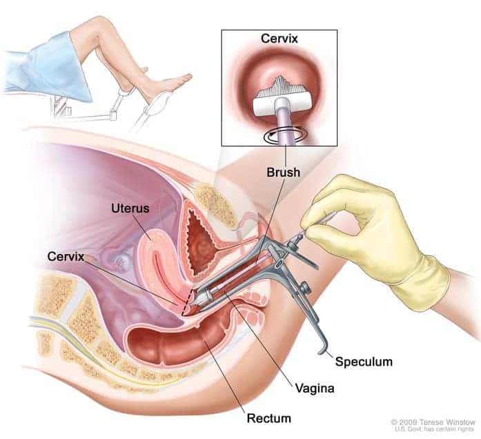 Pap Test